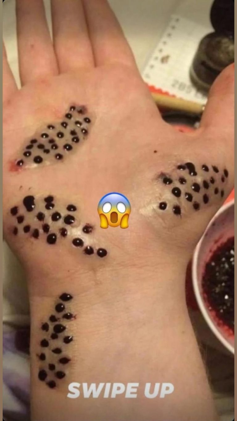 SEVEN THINGS THAT CLOG YOUR PORES AND CAUSE ACNE Uncategorized samibaj