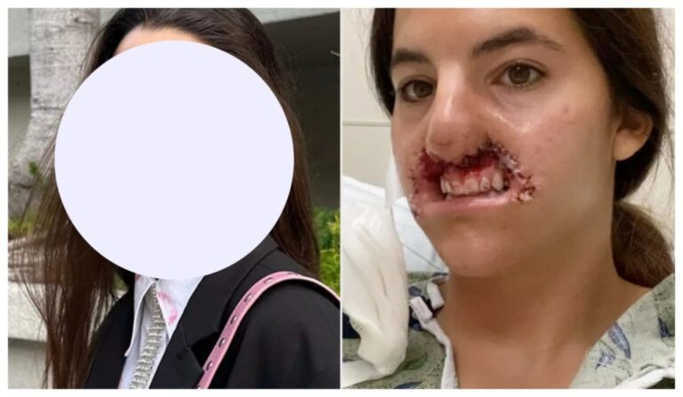 After her last lip reconstruction surgery, Brooklinn Khoury has shared a photo of herself and referred to the surgeon as a “true artist.”