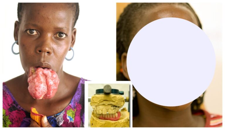 This facial transformation is really incredible… See the result here…