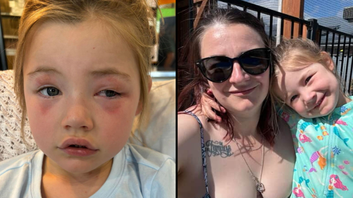 Mother Speaks Out After Toddler Blinded by High-Alkaline Detergent Pod at Home