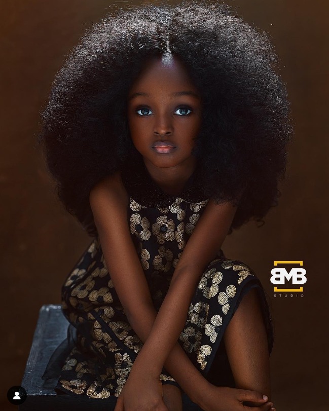 When She Was 5 She Had ‘The Most Beautiful Face In The World’ But Wait Till You See Her Today