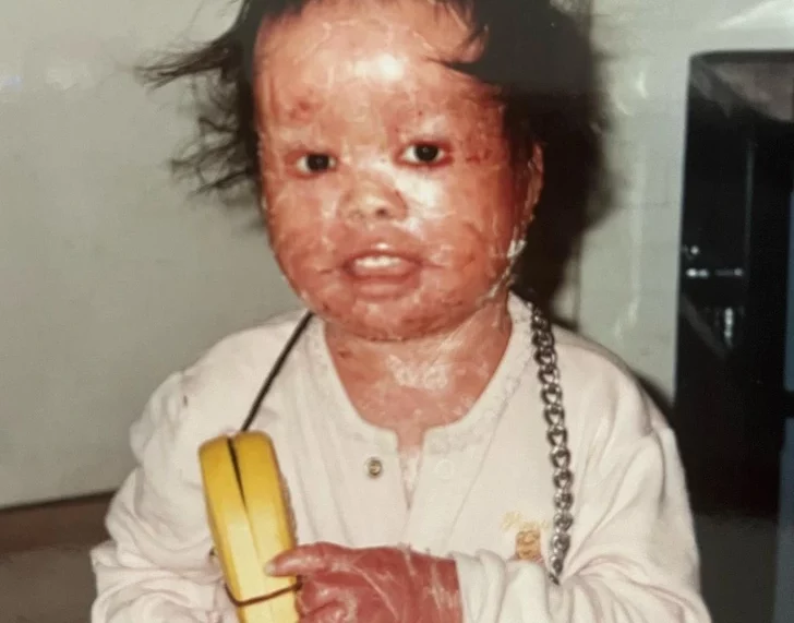 A couple decides to adopt a baby with red skin who seemed to have a little chance of survival and raises her to become a true champion…