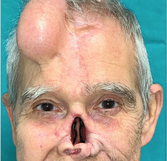 This transformation is really incredible… This man became handsome after surgery…