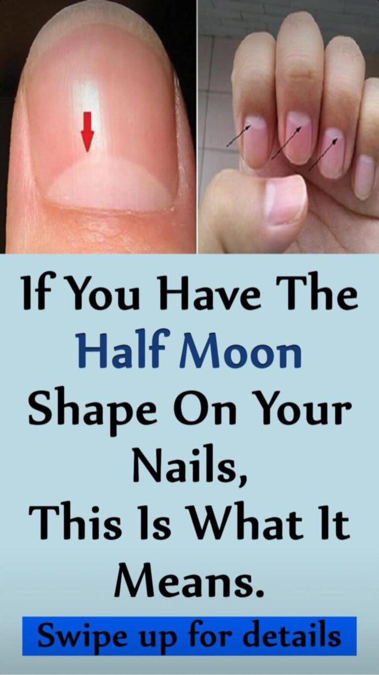 This Is What Happens If Your Nails Are Shaped Like A Half Moon