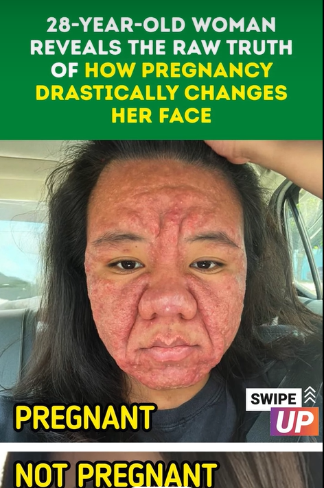 28-Year-Old Woman Reveals the Raw Truth of How Pregnancy Drastically Changes Her Face