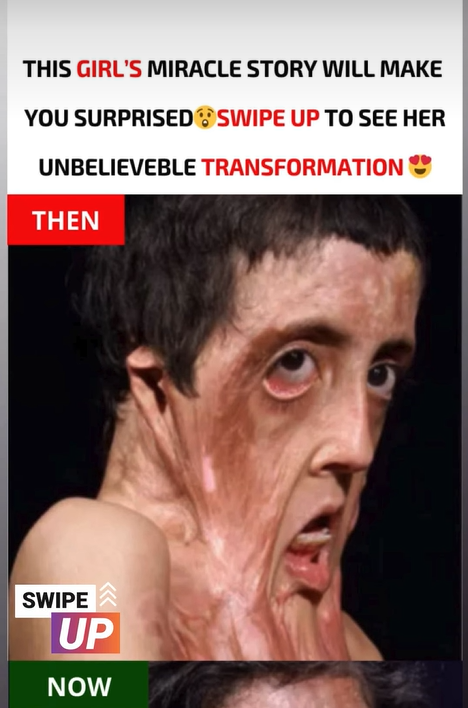 This girl’s miracle story will make you surprised… Know more below…